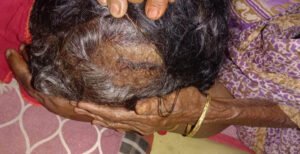 হাটশ হরিপুরে পল্লব গং এর হামলায় হাসপাতালের বিছানায় যন্ত্রণায় কাতরাচ্ছে অর্ধ বয়সী নারী