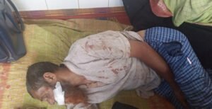 কুষ্টিয়ায় জমাজমি সংক্রান্ত বিরোধের জের ধরে হামলায় আহত ২, থানায় মামলা