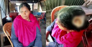 কুমারখালীতে তুচ্ছ ঘটনাকে কেন্দ্র করে যুবকের কোপে মহিলা আহত