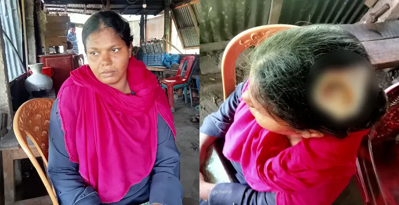কুমারখালীতে তুচ্ছ ঘটনাকে কেন্দ্র করে যুবকের কোপে মহিলা আহত