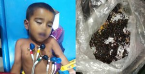 কুমারখালীতে ভুট্টা ক্ষেতে দেওয়া বিষ মাখা খাবার খেয়ে শিশুর মৃত্যু