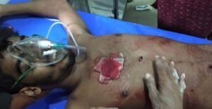 কুমারখালীতে বন্ধুর ছুরিকাঘাতে বন্ধুর মৃত্যু 