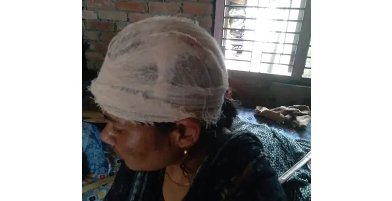 কুষ্টিয়ায় জমি নিয়ে বিরোধের জেরে প্রতিবেশীর হামলায় দুই বোন আহত