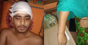 কুমারখালীতে জাল দলিলকারী নির্দেশে হামলায় আহত ২