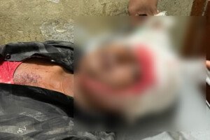 ভেড়ামারায় গৃহবধূর পরকীয়ার জেরে স্বামীকে কুপিয়ে জখম