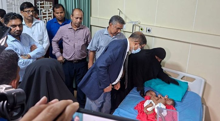 পেট জোড়া লাগানো ২ শিশুকে দেখতে গেলেন স্বাস্থ্যমন্ত্রী