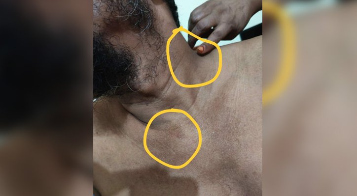 কলেজ শিক্ষকের বিরুদ্ধে ছাগল ব্যবসায়ীকে মারধর ও টাকা লুটের অভিযোগ