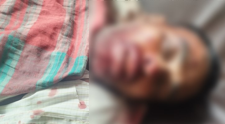 07 17 ভেড়ামারায় ত্রিমুখী সংঘর্ষে সিএনজি যাত্রী নিহত