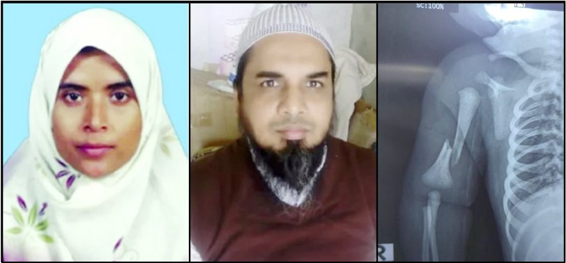 09 28 সিজারে নবজাতকের হাত ভাঙার পরে হার্টের সমস্যায় রেফার