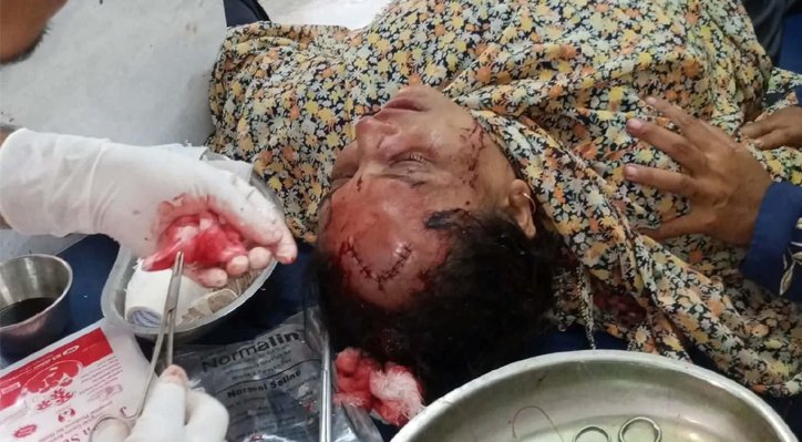 মিরপুরে মানসিক ভারসাম্যহীন বাবাকে দিয়ে জমি লিখে নেওয়ার চেষ্টা 2 মিরপুরে মানসিক ভারসাম্যহীন বাবাকে দিয়ে জমি লিখে নেওয়ার চেষ্টা 15 6 মিরপুরে মানসিক ভারসাম্যহীন বাবাকে দিয়ে জমি লিখে নেওয়ার চেষ্টা