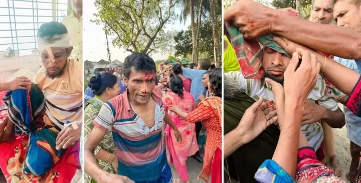 পূর্ববিরোধের জেরে দুই ভাইকে কুপিয়ে জখম 3 পূর্ববিরোধের জেরে দুই ভাইকে কুপিয়ে জখম 07 1 পূর্ববিরোধের জেরে দুই ভাইকে কুপিয়ে জখম