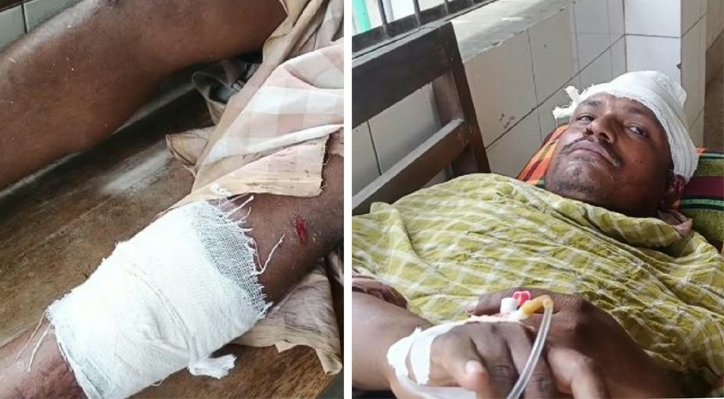 10 4 দৌলতপুরের চিলমারীতে মানববন্ধনে হামলার অভিযোগ